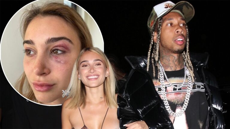 Tyga tự đầu thú sau những cáo buộc bạo hành của người tình cũ