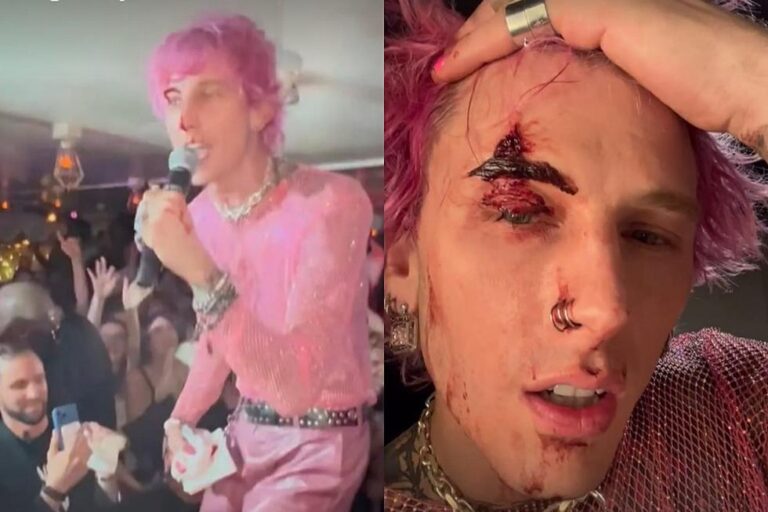 Machine Gun Kelly bị thương trong buổi biển diễn của mình